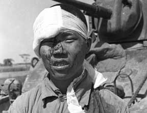 美拍49年内战时国军伤员