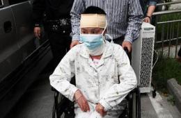 少女拒绝求爱遭毁容案开庭