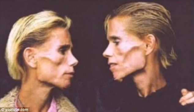 澳<em>厌食症</em>双胞胎<em>姐妹</em>命丧大火_图片_环球网