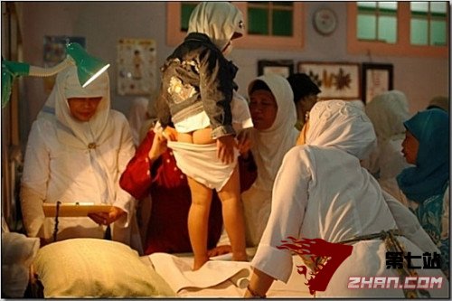 实拍印尼女孩割礼手术