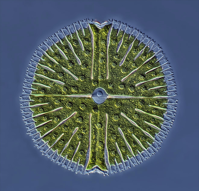 2012最佳微生物照片:睡莲叶上的轮虫群夺冠