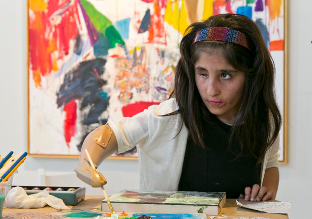 阿遭炸伤<em>小女孩</em>带假肢乐观<em>学</em>画画_中搜论坛_