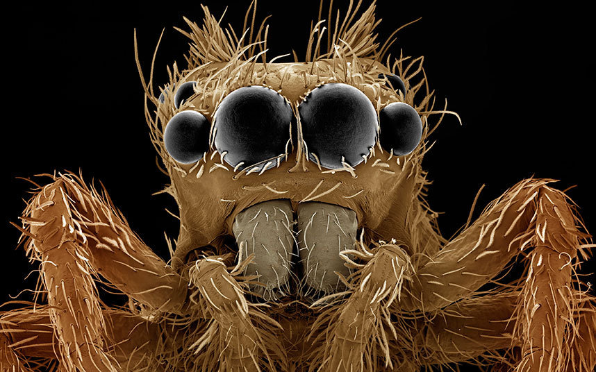 电子显微镜下的微小生命:苍蝇眼睛似红宝石(3
