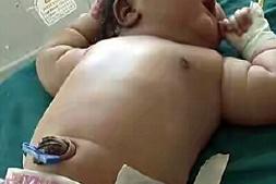 印度母亲生下14斤女童或创世界纪录