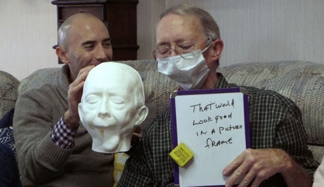 癌症患者失去下巴 3D打印技术为其重建面部