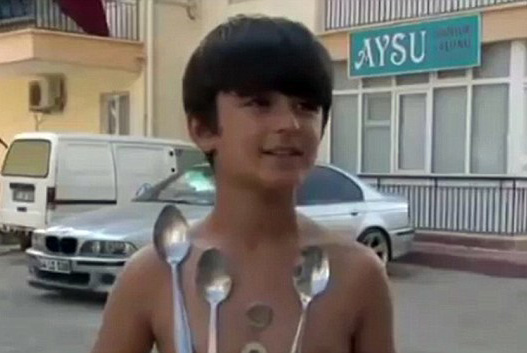 土耳其现实版“小万磁王”身体可吸上金属餐具