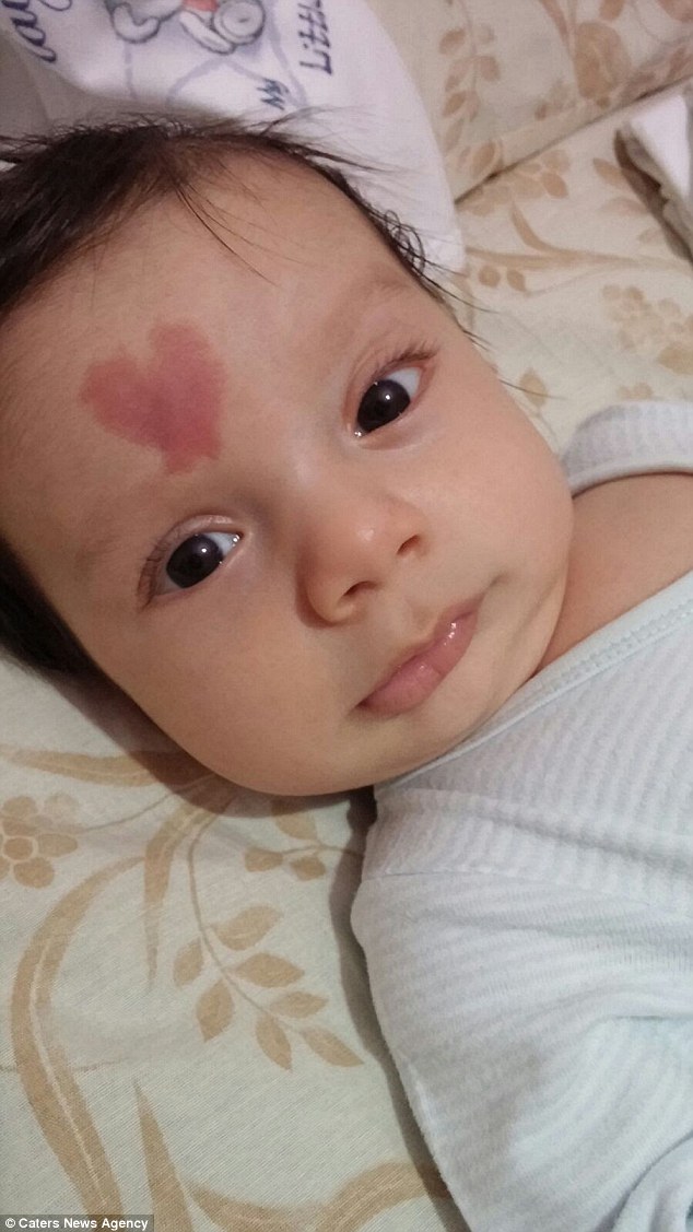土耳其婴儿额头有心形胎记 一出生就走红