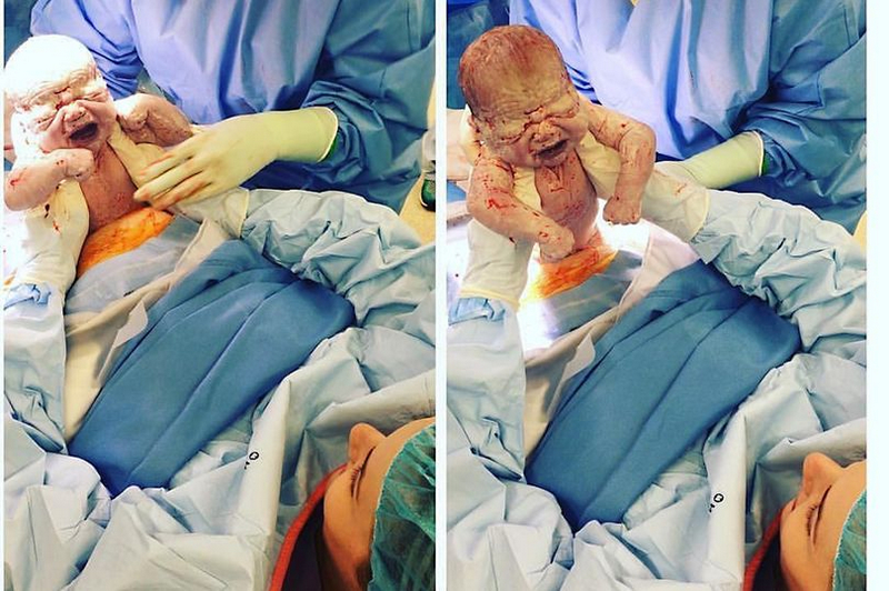 厉害了！澳孕妇亲自助产剖腹手术“自取”婴儿