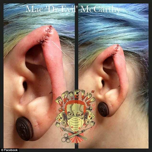 英纹身师涉嫌割顾客耳朵舌头被称“恶魔医生”