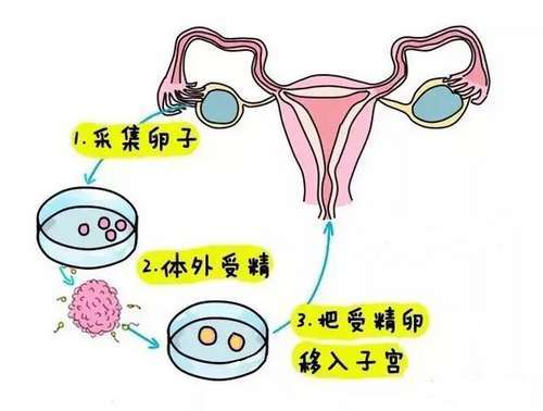 李湘、王岳伦夫妇现身泰国杰特宁医院做试管怀二胎?!_娱乐_环球网