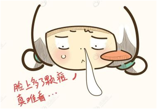 20170222062935178.png