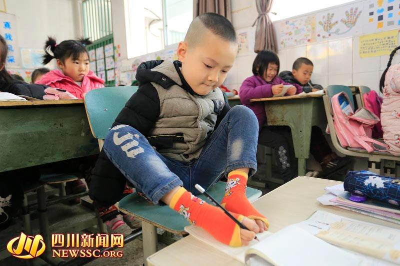 8岁无臂男孩考出双优生 曾脚“捻”头发丝训练双脚