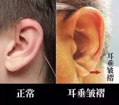 心脏好不好就看这七处