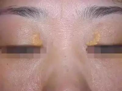 心脏好不好就看这七处