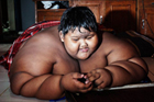 世界最胖男孩重380斤