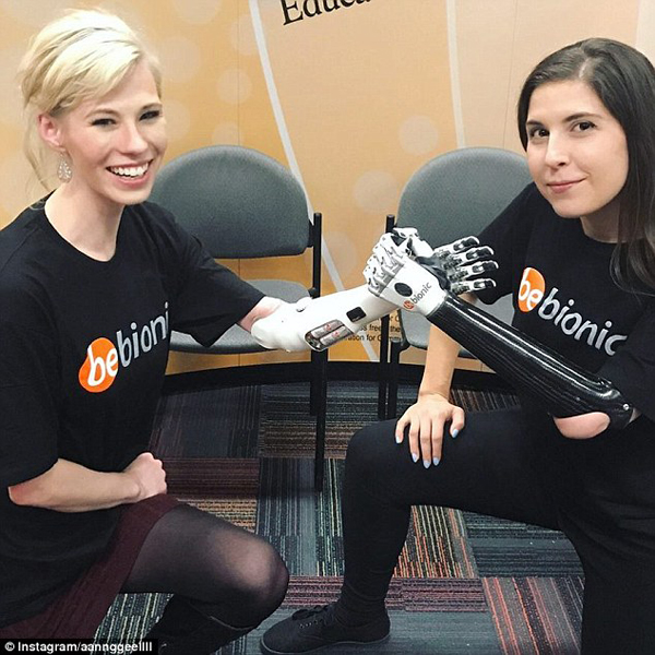 美残疾女子为高科技假肢充电照片网上引热议
