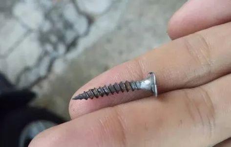 23岁小伙在家拧螺丝手起泡 手指头感染最终被截指