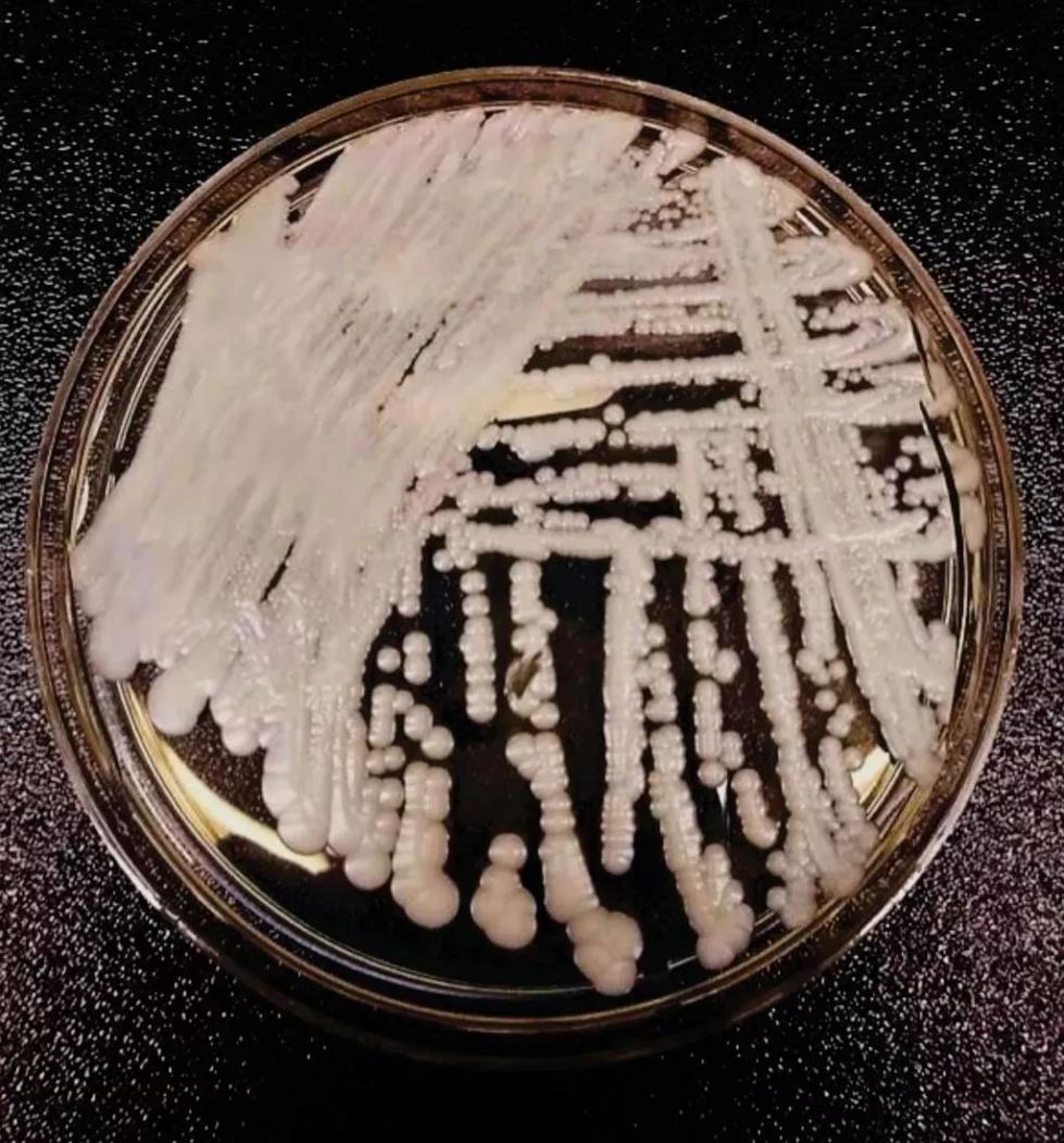 中国确诊18例超级真菌感染,生化危机真的来了