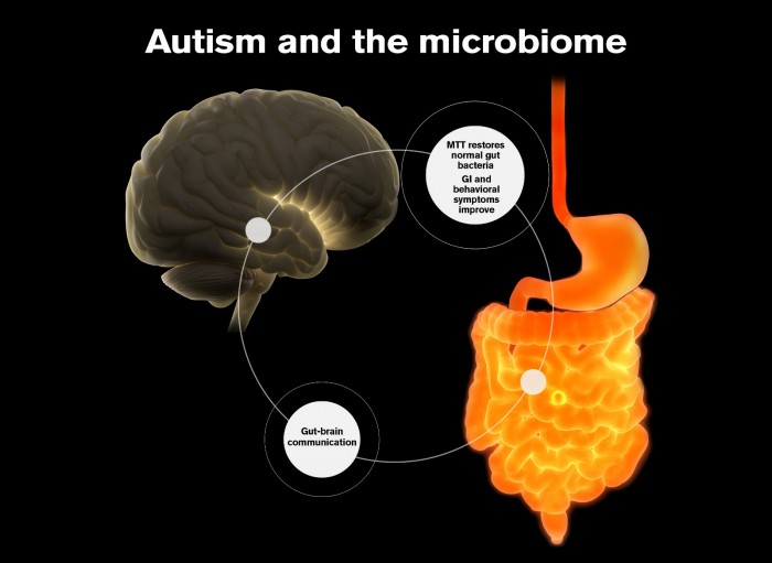 研究称粪便菌群移植大幅缓解了儿童的自闭症症状