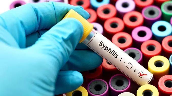 梅毒再次席卷欧洲，病例首超艾滋病