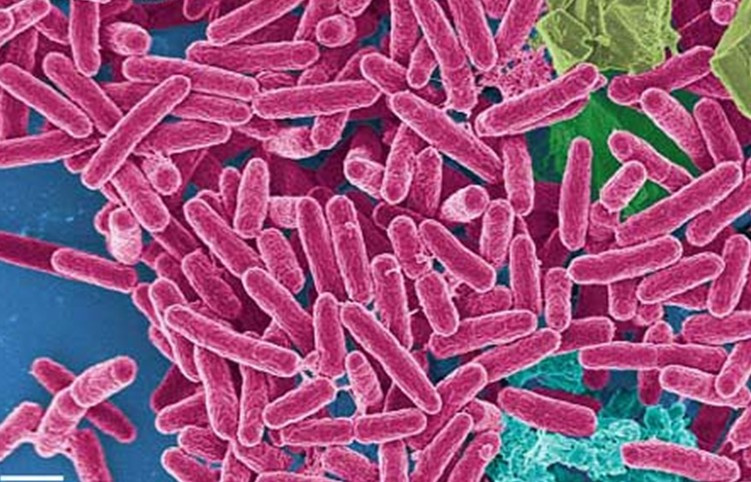 绿脓杆菌致病性较弱但抗药性强 来源于痰液