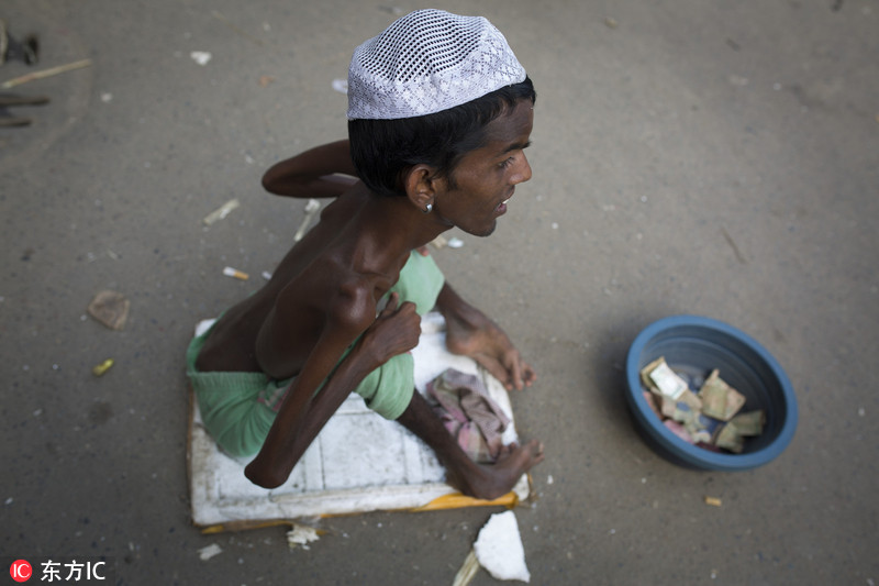 实拍孟加拉国街头乞讨者骨瘦如柴