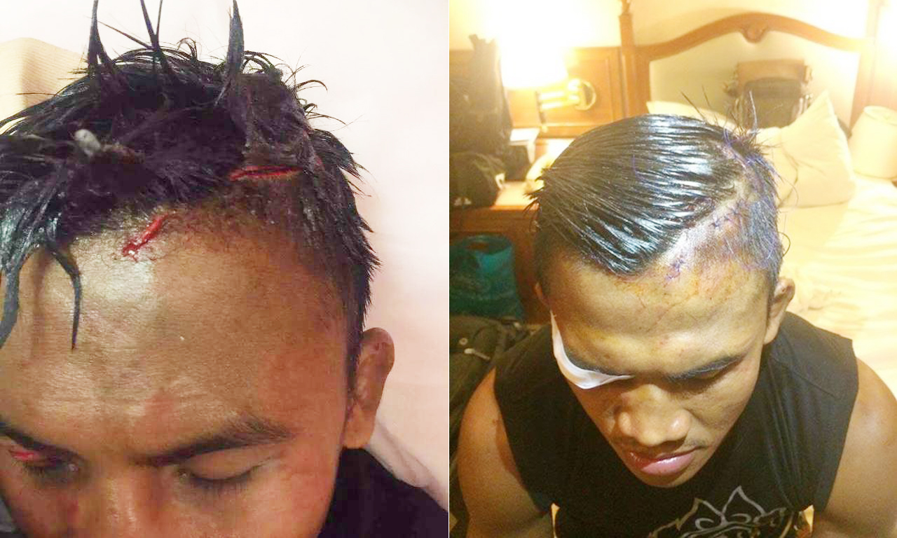 开局后不久,播求的头部便被对方的重击打破,鲜血飞溅,流血量之大,放眼