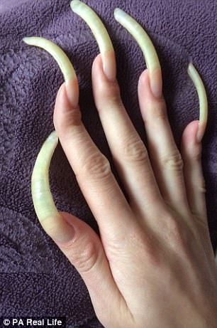 德16岁学生拒剪指甲3年后长至15厘米