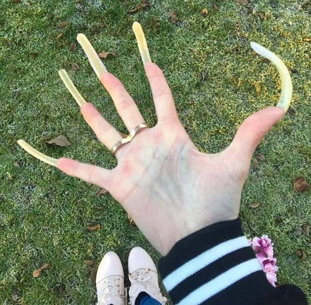 德16岁学生拒剪指甲 3年后长至15厘米