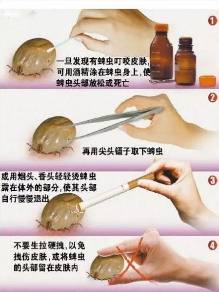 多彩贵州网 多彩贵州网国内国际 国内  "如果发现身上停留隐翅虫,千万